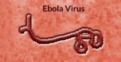 埃博拉病毒是什么症状